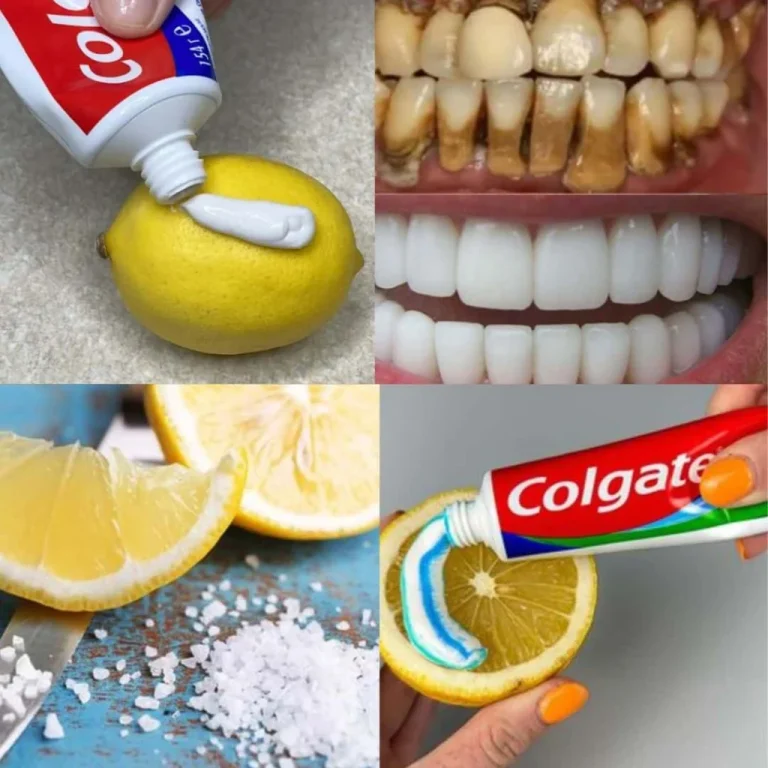 recette-naturelle-pour-blanchir-les-dents-avec-du-citron-1024×1024.jpg