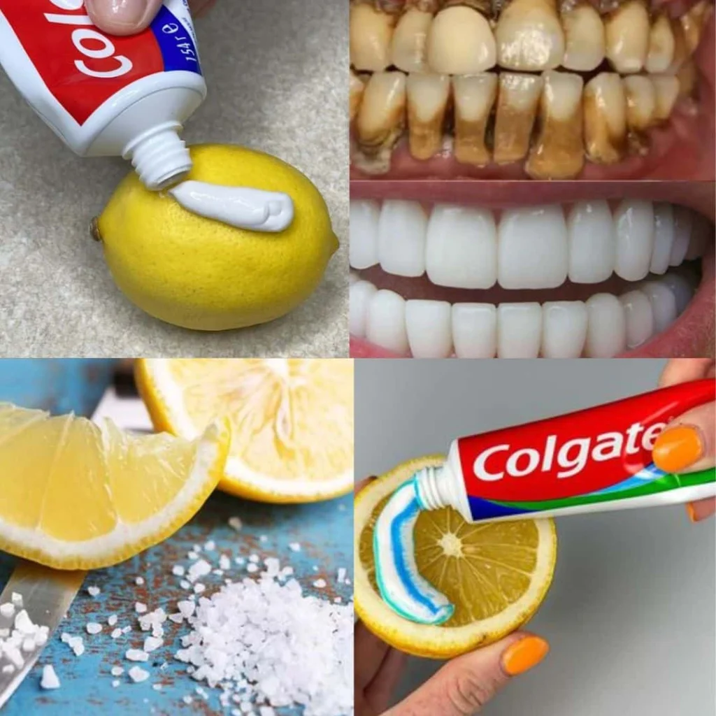 recette-naturelle-pour-blanchir-les-dents-avec-du-citron-1024×1024.jpg recette-naturelle-pour-blanchir-les-dents-avec-du-citron-1024×1024.jpg
